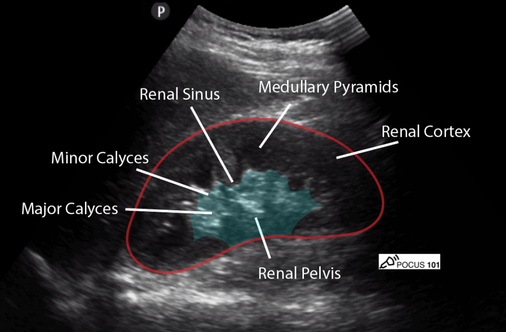 Renal Ultrasound